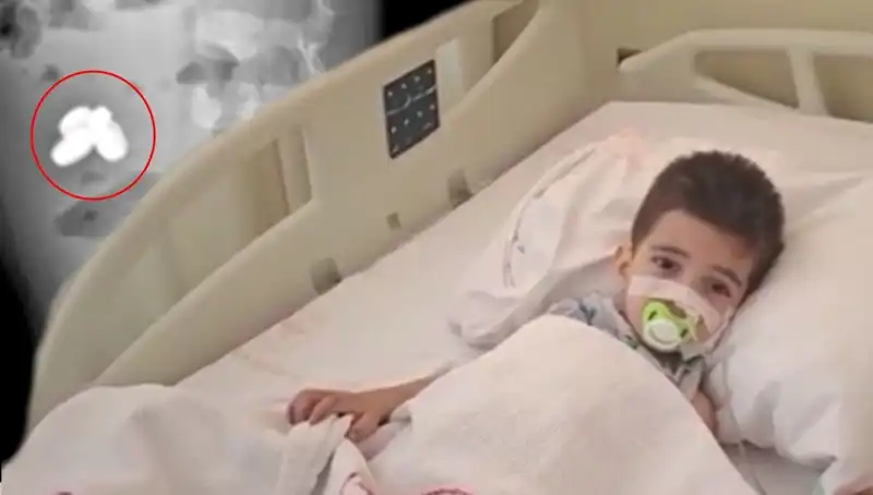 Çocuğun İnanılmaz Korku Dolu Deneyimi: Pil ve Mıknatıs Yutan Küçük Kahraman
