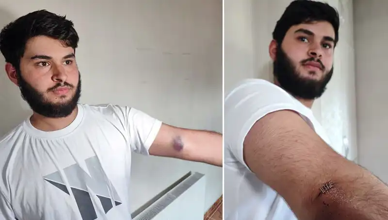 Bahçeye Kaçan Top, Mahalleyi Karıştırdı: Conolar Kamyonetle Geldi