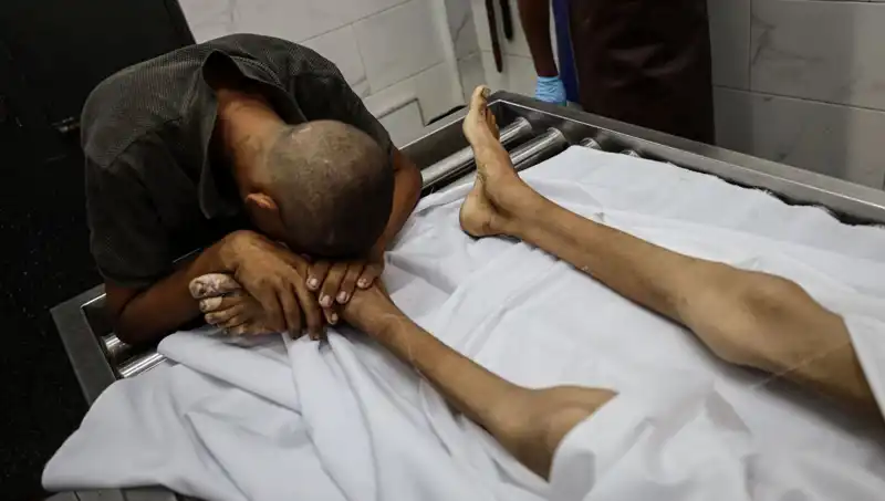 Gazze’de Açlık Korkunç Boyutlara Ulaşıyor: Bir Çocuk Daha Hayatını Kaybetti
